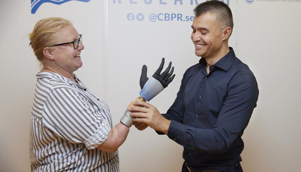 Revolution in Prosthetics: Integration of AI-Controlled Hand Prosthesis with Human Nervous and Skeletal System
